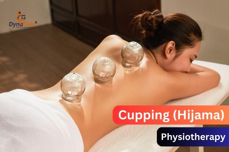 How Cupping Therapy Can Boost Your Performance and Recovery