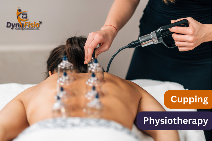 Explore the Benefits of Cupping Therapy for Improved Health and Well being in Gurgaon