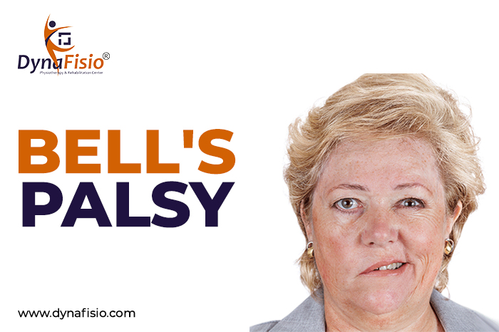 BELL’S PALSY – How Our Physiotherapists Can Help