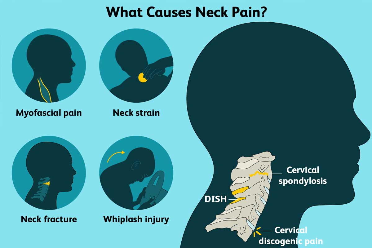 Neck Pain Treatment In Gurgaon